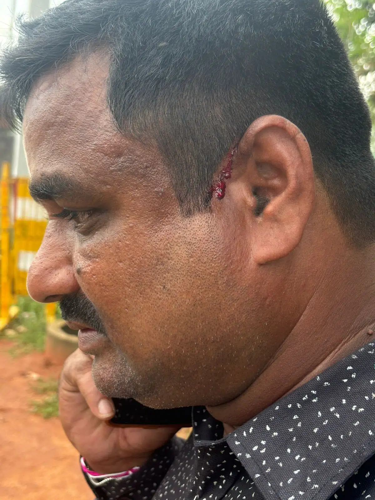 పాత్రికేయుడిపై దాడిని తీవ్రంగా ఖండించిన జర్నలిస్టు సంఘం