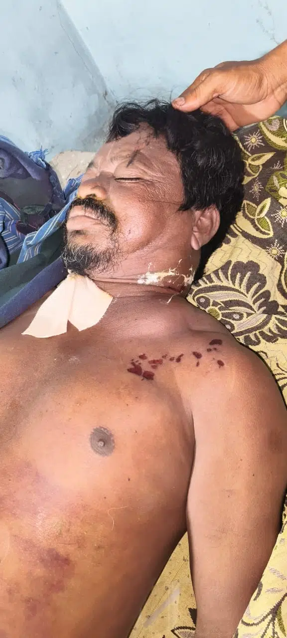 పిడుగుపాటుకు పశువుల కాపరి దుర్మరణం